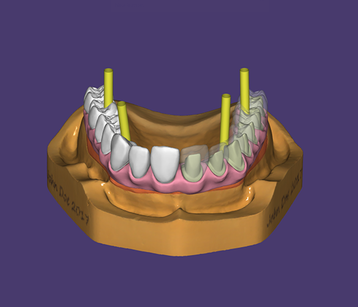 Lab Order Form - Restorative