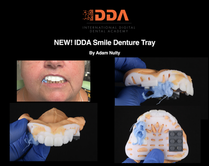 Custom Denture Tray Design with Custom Teeth