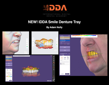 Custom Denture Tray Design with Custom Teeth