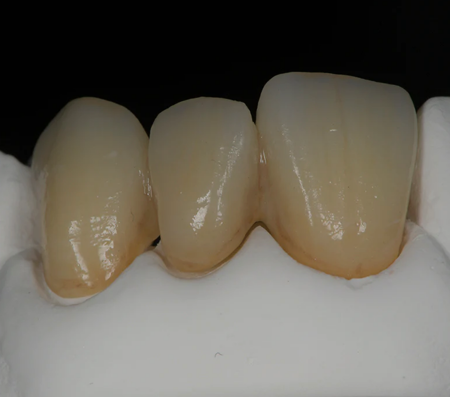 CAD & PRODUCTION - Zirconia Crown/Bridge (Per Unit)