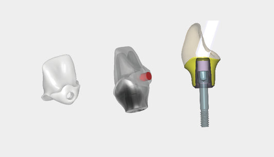 Screw Retained / Simple Bridge (Per Unit)